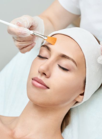 What is a Chemical Peel?