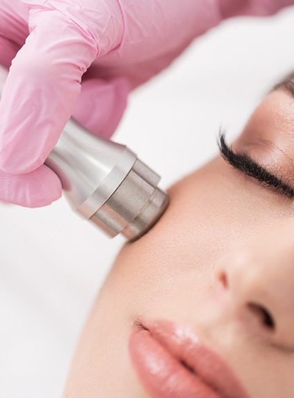 What is Microdermabrasion?