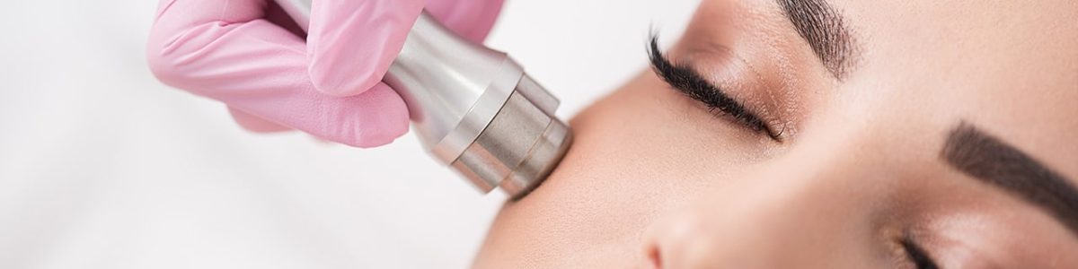 What is Microdermabrasion?