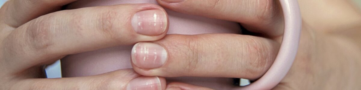 White Spots on nails